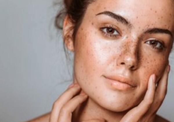 Solution-for-pigmentation-Reverse Skin Clinic